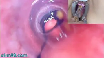 Wanita dewasa lubang kencing kamera endoskopi kamera film seks